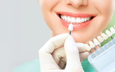 Как можно отбелить зубы в Киеве за 1 день?